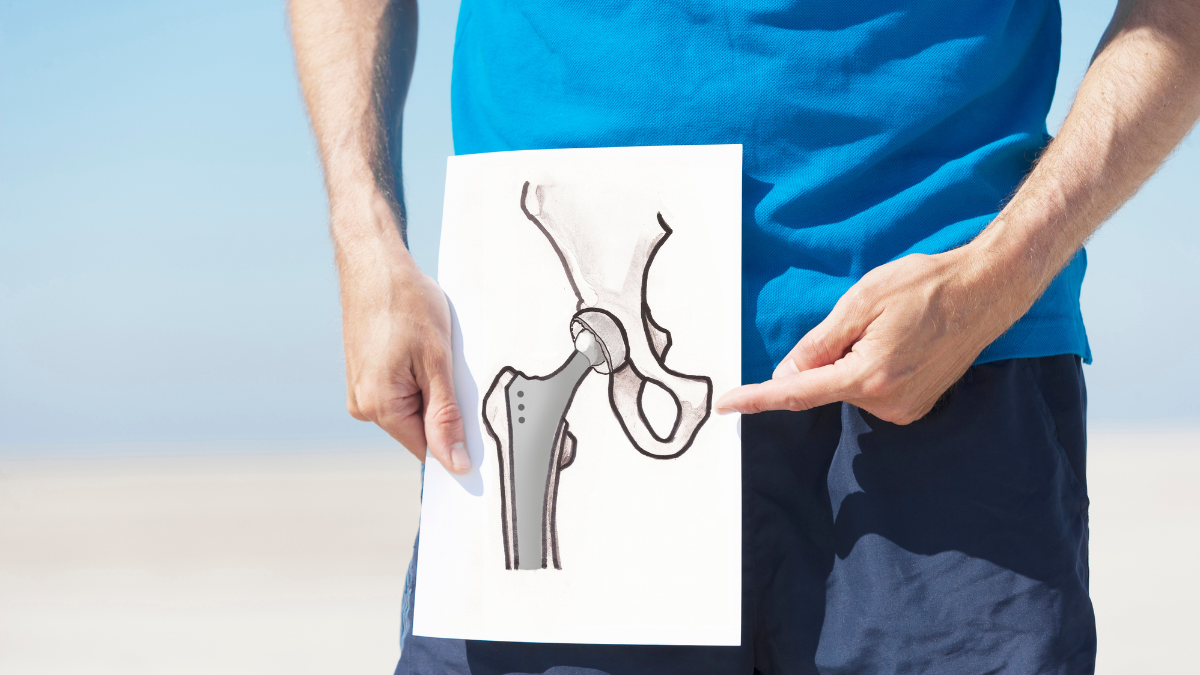 Do I need a hip replacement?